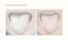 王瑞宽沈氏女科舌诊基础入门诊疗要点案例视频17讲