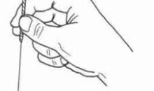 经典针灸方-针灸培训视频