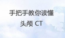 手把手教你读懂头颅 CT 全集298元