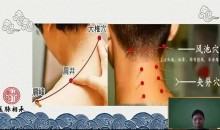 医脉相承王瑶十五组针灸特效方-中医特效针灸教学