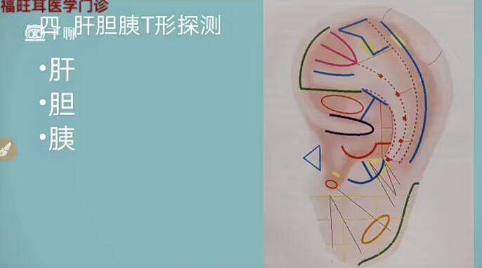 张福旺精讲耳穴诊断班