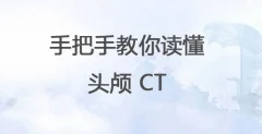 手把手教你读懂头颅 CT 全集298元