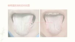王瑞宽沈氏女科舌诊基础入门诊疗要点案例视频17讲